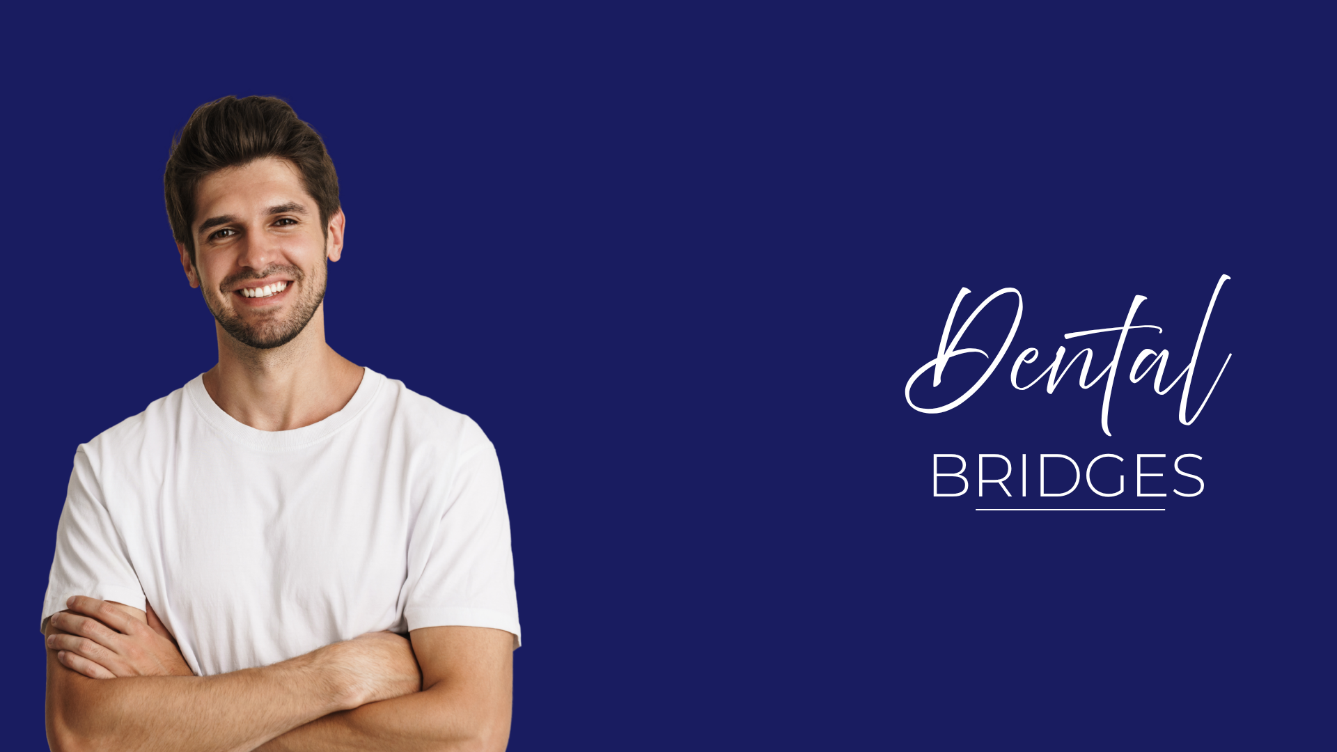 Dental Bridges