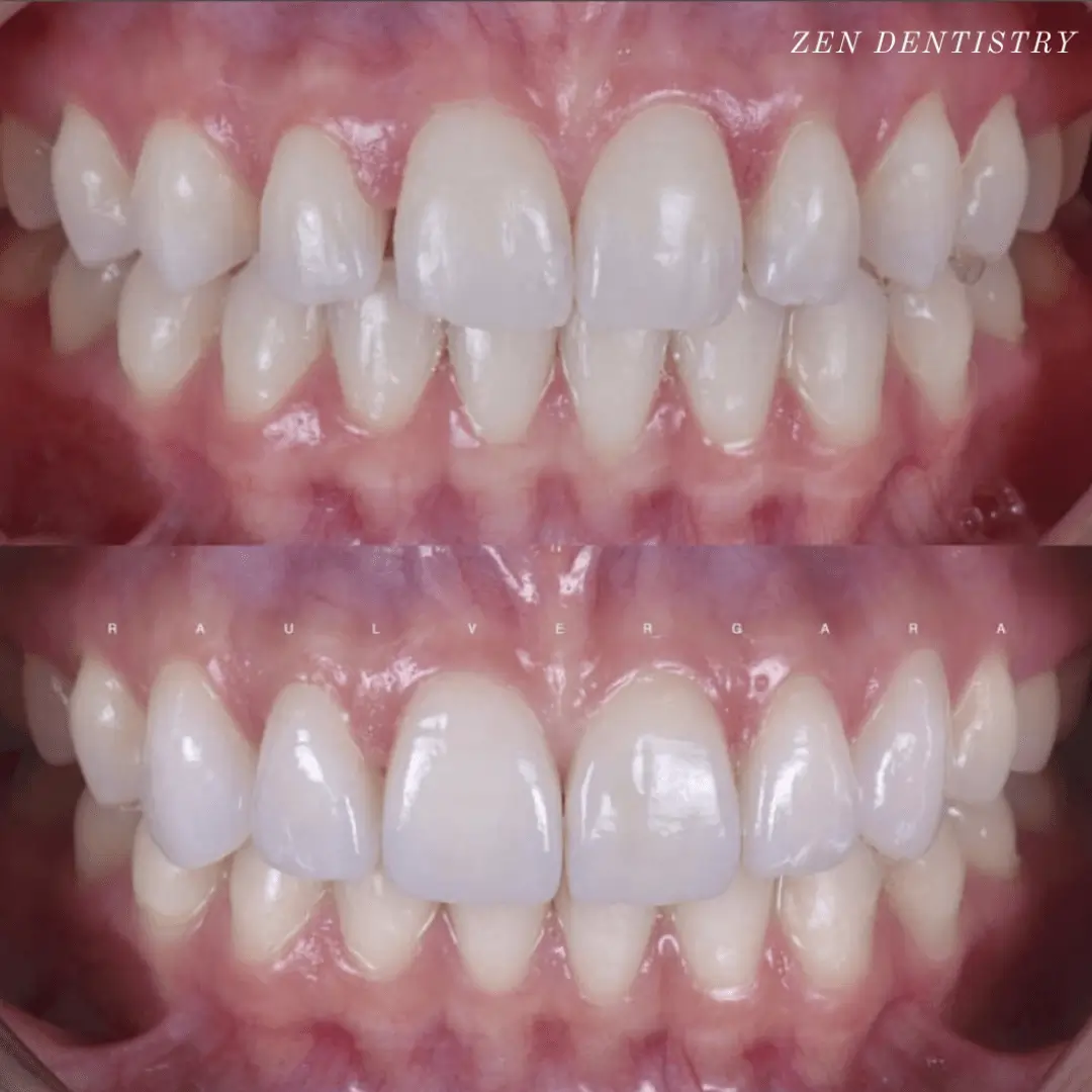 before-after-3.webp