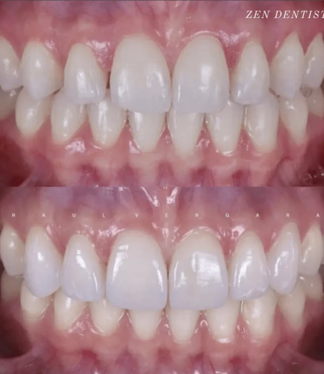 before-after-3.webp